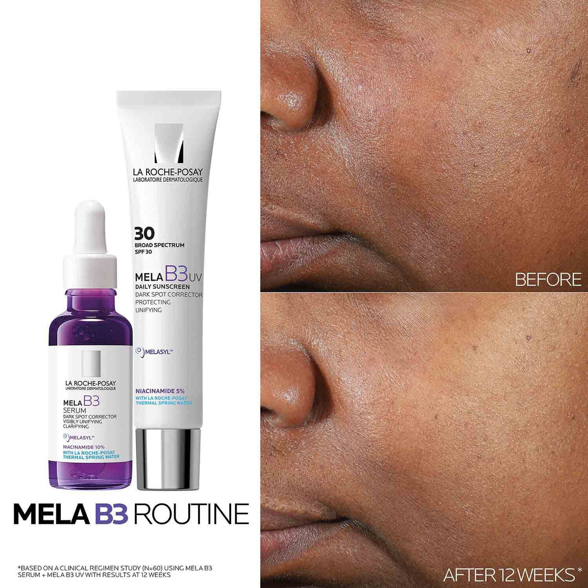 Mela B3 Dark Spot Serum With Melasyl™ + Niacinamide